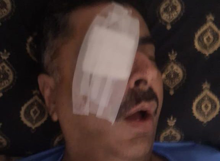 ڈی آئی جی آپریشنز  لاہور علی ناصر  رضوی پی ٹی آئی مظاہرین کے حملے میں شدید زخمی